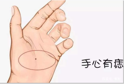 掌心痣是福是禍,看完這三點,再決定要不要點痣 掌心痣是福是禍,看完這三點,再決定要不要點痣